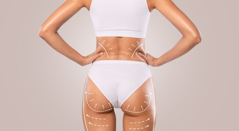 Woman close up photo of surgical markings