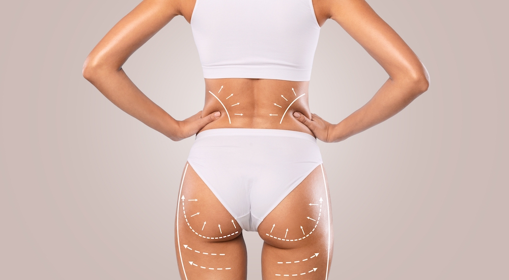 Woman close up photo of surgical markings